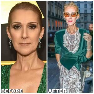 Celine Dion Weight Loss Before and After