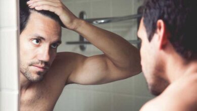 Receding Hairline: Stages, Causes, and Treatments